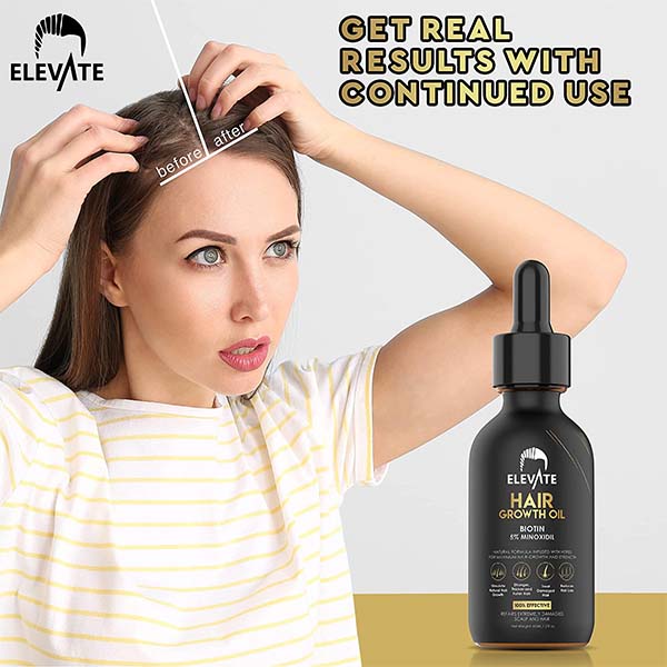 ELEVATE Hair Growth Oil